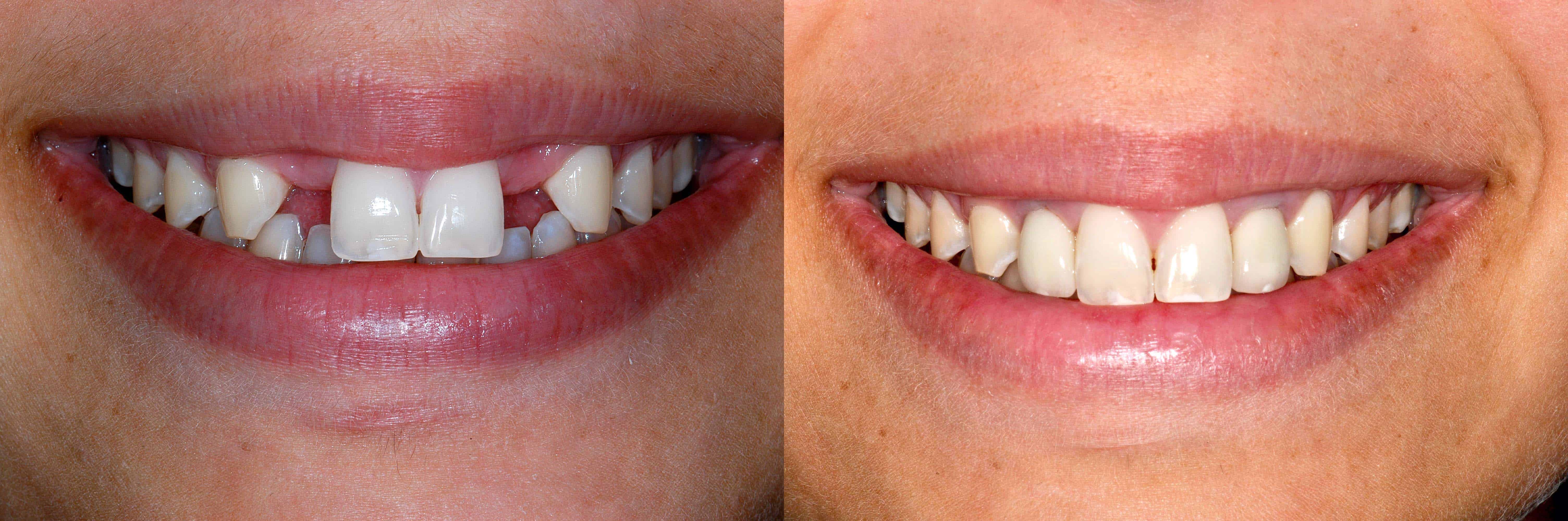 dental implants by forestbrook dental