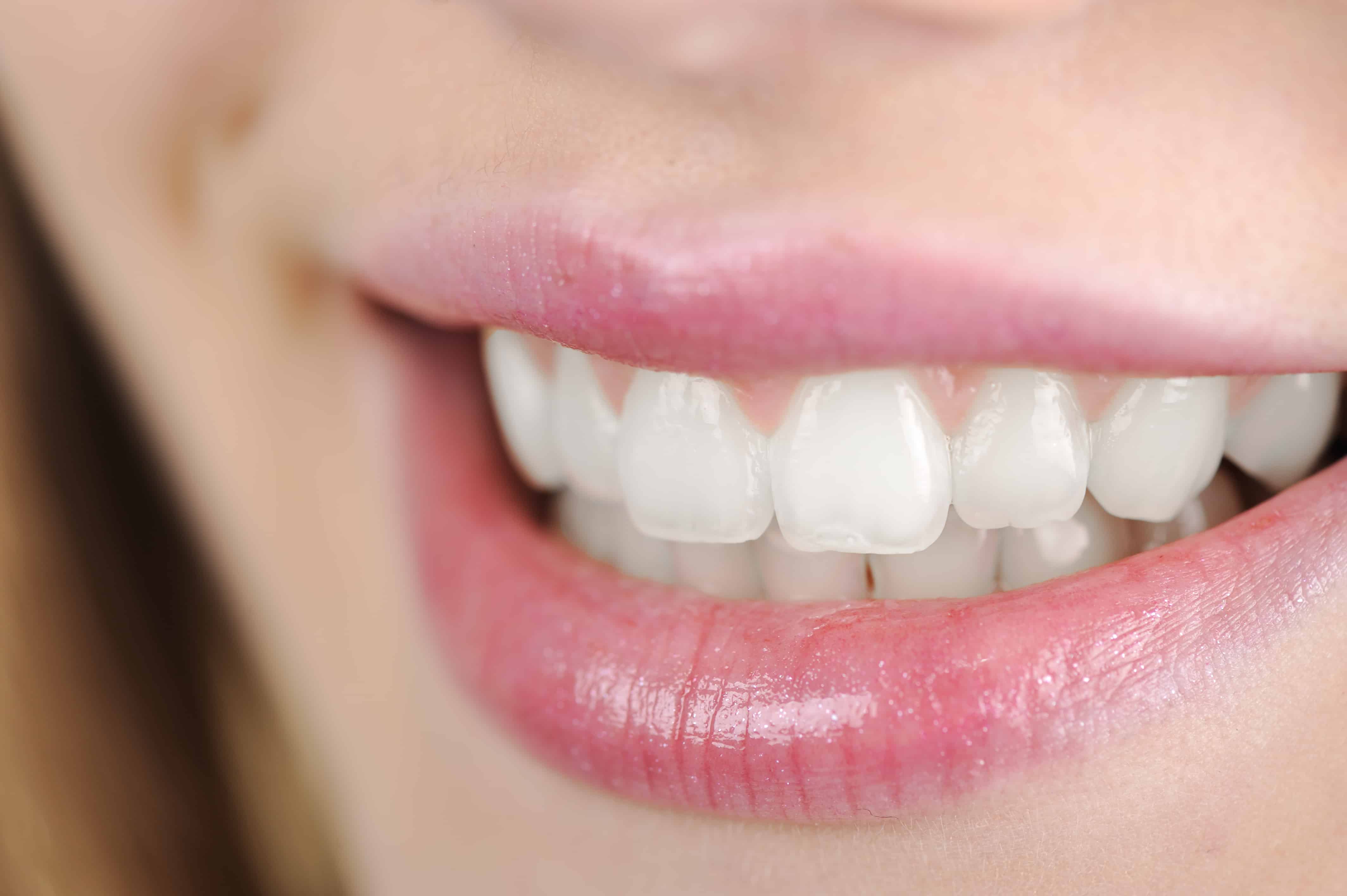 woman white teeth