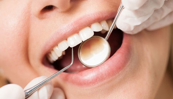 Dental Cleanings Markham - Markham Dentist - Forestbrook Dental