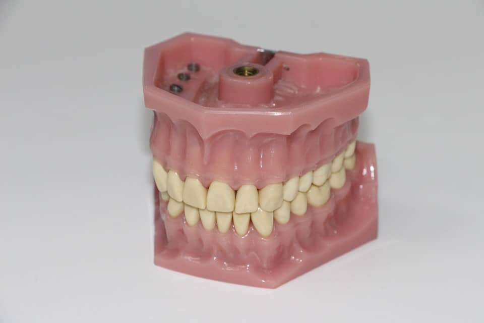 waterloo dental bridges Markham Dentist Forestbrook Dental