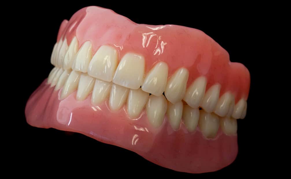 Fixed Dental Restoration - Markham Dentist - Forestbrook Dental Clinic