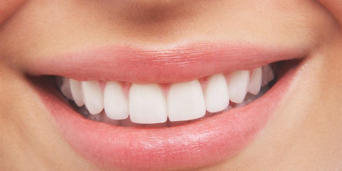 Dental Bonding: Your Practical Guide To Perfect Teeth-2