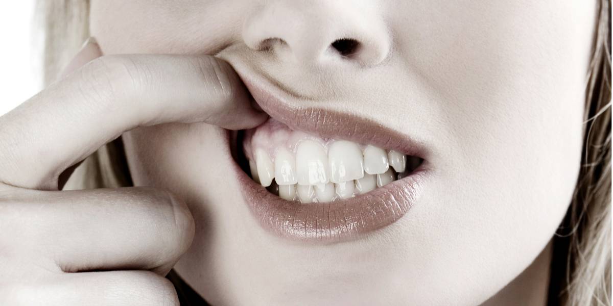 6 Shocking Facts That Lie Behind Your Dental Veneers - Forestbrook Dental - Markham Dentist