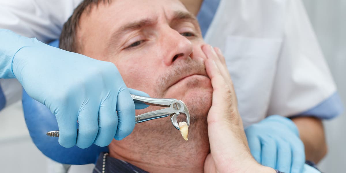 10 Best Tips To Prevent Wisdom Tooth Extraction Complications