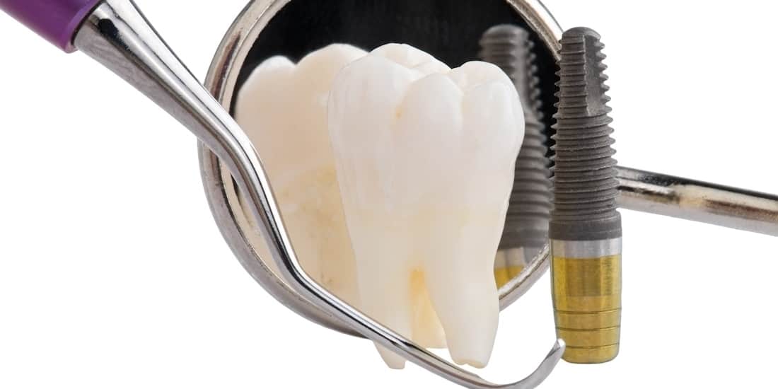 Markham Dentist - Forestbrook Dental