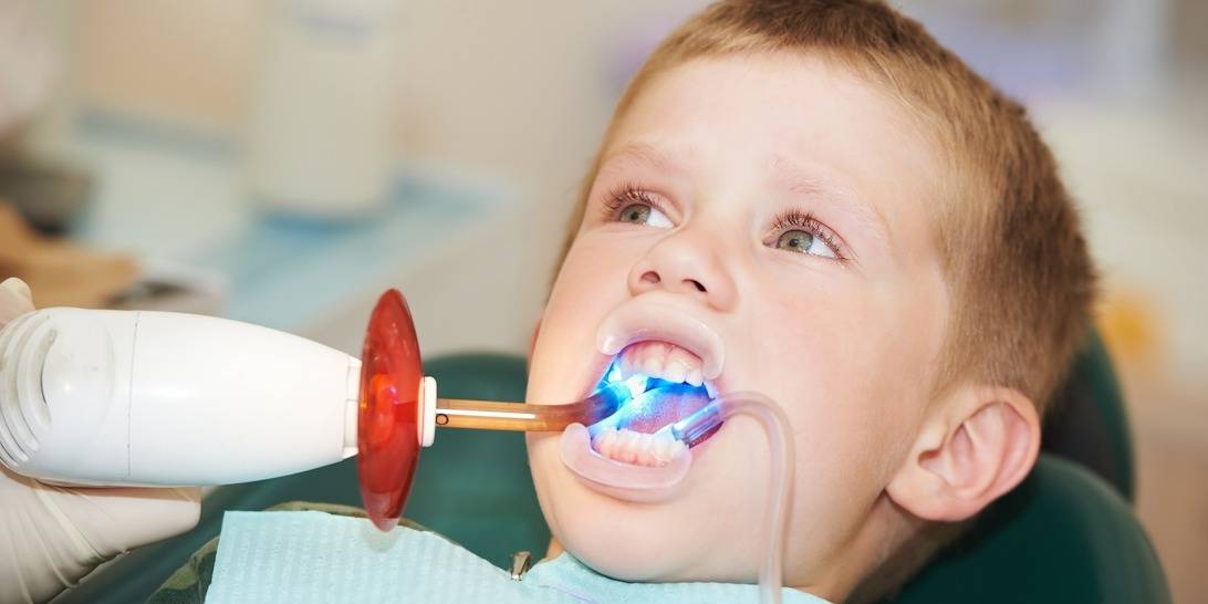 dental sealants for kids - Forestbrook Dental
