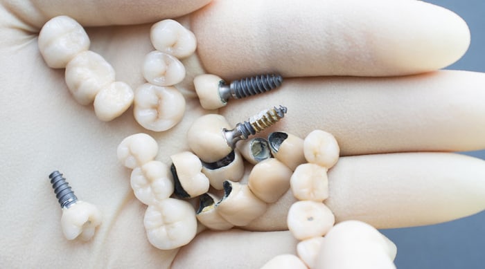 dental implants - Forestbrook Dental