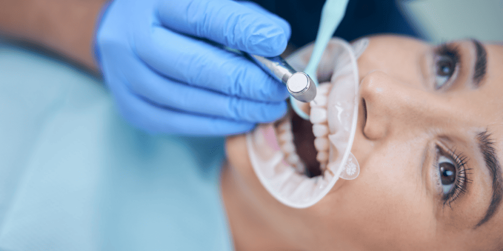 Dental cleaning for healthy teeth
