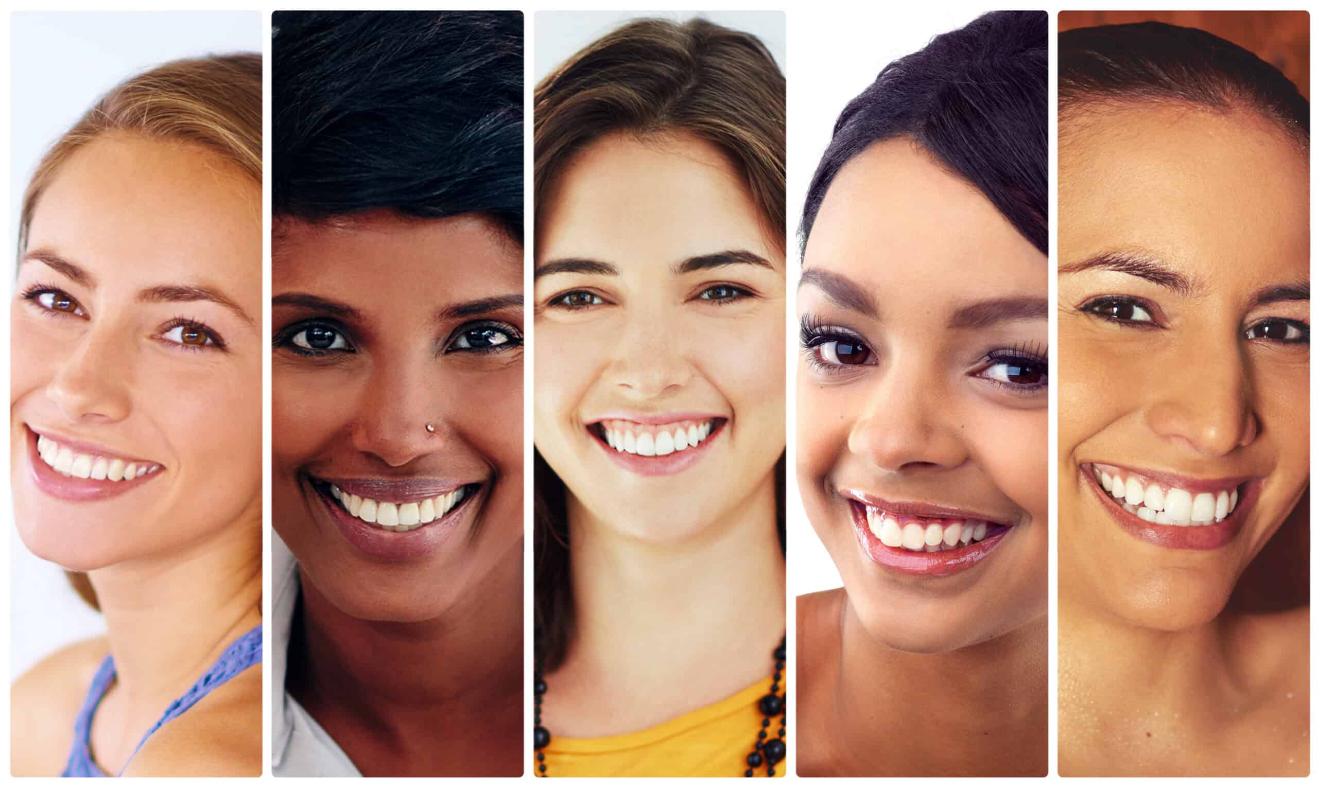 Are Veneers Permanent? Exploring the Lifespan of Your Smile