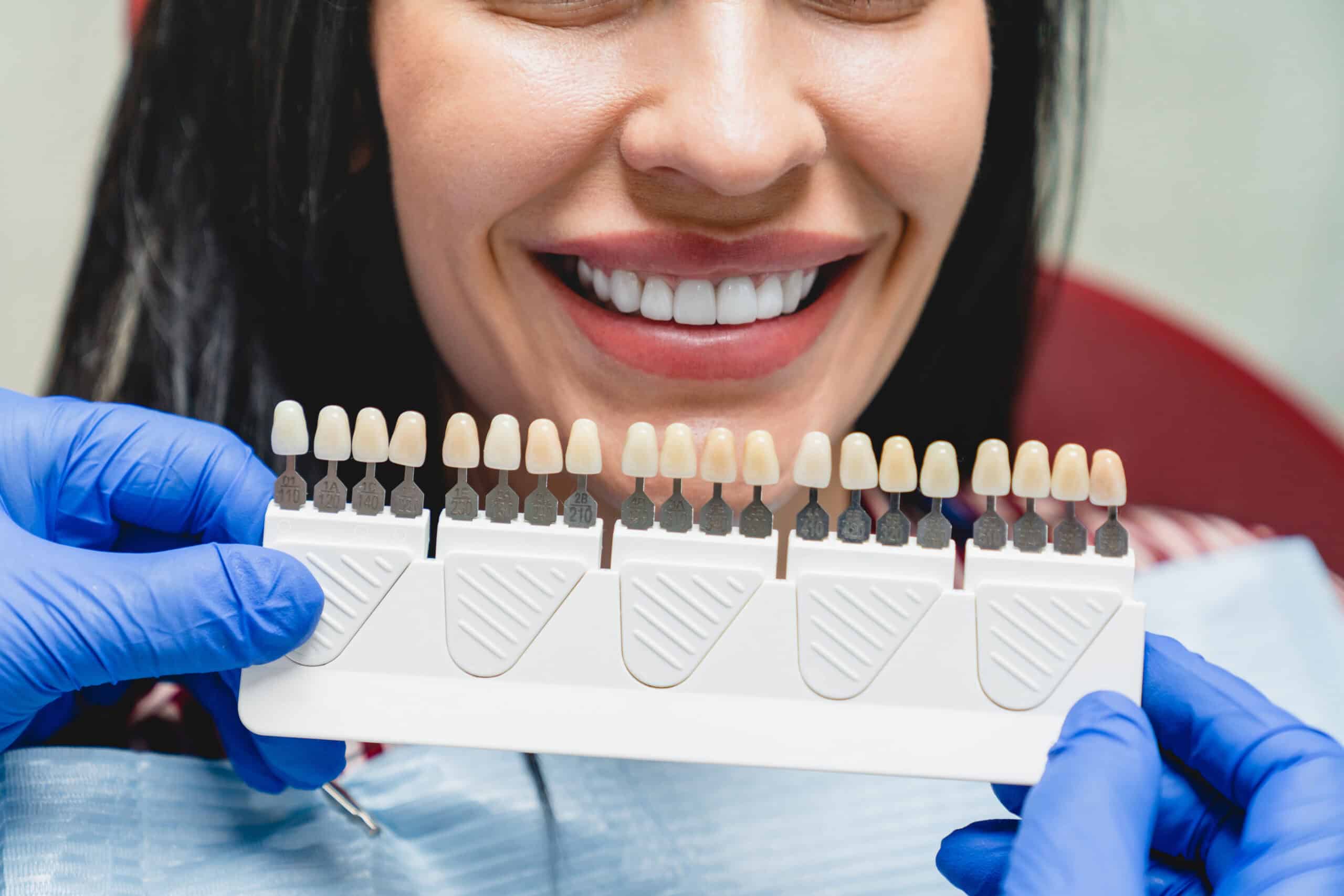 Can Veneers Make Your Teeth Bigger? Insights From Your Dentist